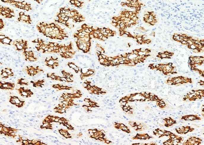 Anti-Human ACE2 Antibody [A1137] - ABMIUM