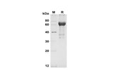 SDS-PAGE analysis of Human SEPP1 proteins, 2 μg/lane of Recombinant Human SEPP1 proteins was resolved with SDS-PAGE under reducing conditions, showing bands at 65-70 kDa.