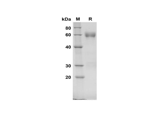 SDS-PAGE analysis of Rat C1Inh proteins, 2 μg/lane of Recombinant Rat C1Inh proteins was resolved with SDS-PAGE under reducing conditions, showing bands at 60 kDa.