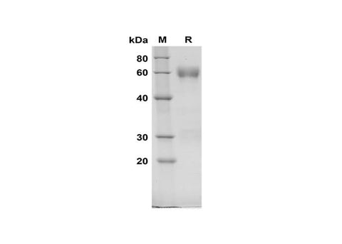 SDS-PAGE analysis of Rat C1Inh proteins, 2 μg/lane of Recombinant Rat C1Inh proteins was resolved with SDS-PAGE under reducing conditions, showing bands at 60 kDa.