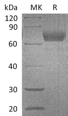 Recombinant Mouse IL4RA/CD124 Protein (Fc Tag) - ABMIUM