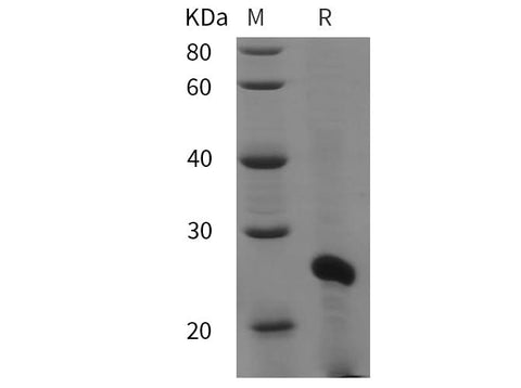 SDS-PAGE analysis of Mouse HP1α proteins, 2 μg/lane of Recombinant Mouse HP1α proteins was resolved with SDS-PAGE under reducing conditions, showing bands at 25 kDa.