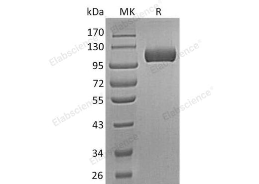 Recombinant Human Semaphorin 5A/SEMA5A Protein (aa 23-765, His Tag) - ABMIUM