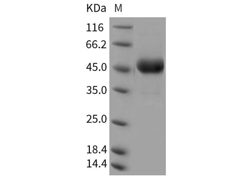 Recombinant Rat CD302/CLEC13A Protein (Fc Tag) - ABMIUM