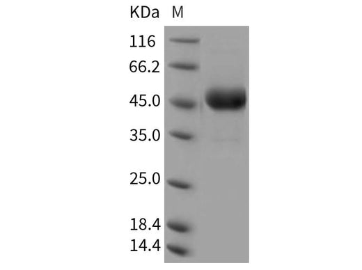 Recombinant Rat CD302/CLEC13A Protein (Fc Tag) - ABMIUM
