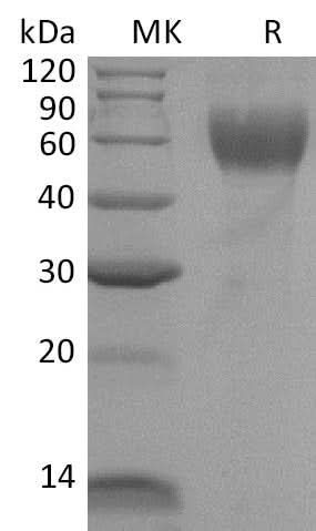 Recombinant Mouse IL1R1/CD121a Protein (His Tag) - ABMIUM