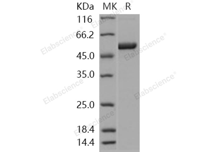 Recombinant Human S100A3/S100E Protein (His & MBP Tag) - ABMIUM
