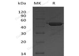 Recombinant Human UBE2G2 Protein (GST Tag) - ABMIUM
