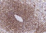 Anti-Human PTPRC Antibody [B215]