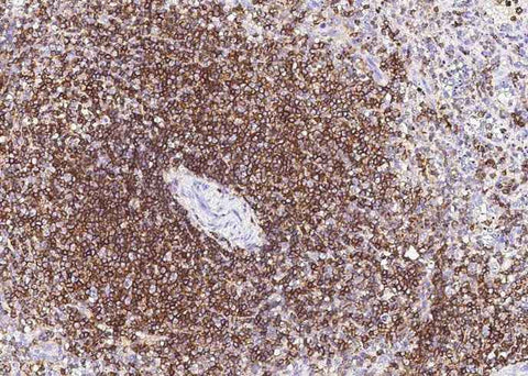Anti-Human PTPRC Antibody [B215] - ABMIUM