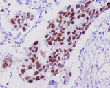 Anti-p53 TP53 Rabbit Monoclonal Antibody Boster Bio
