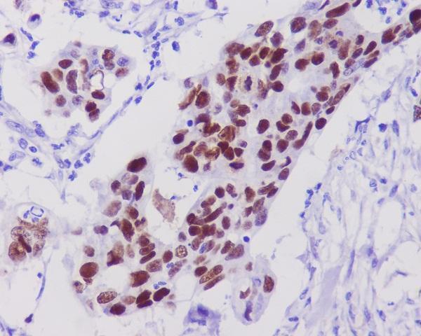Anti-p53 TP53 Rabbit Monoclonal Antibody Boster Bio