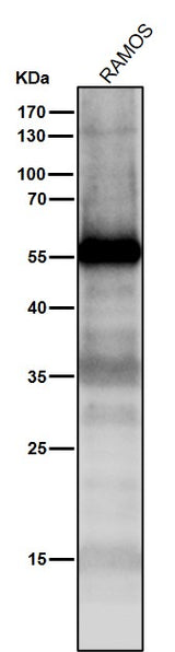 Anti-p53 TP53 Rabbit Monoclonal Antibody Boster Bio
