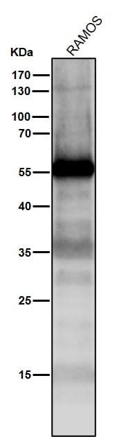 Anti-p53 TP53 Rabbit Monoclonal Antibody Boster Bio