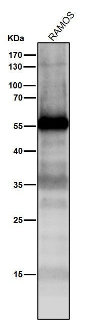Anti-p53 TP53 Rabbit Monoclonal Antibody Boster Bio
