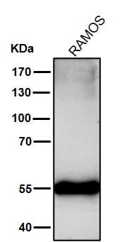 Anti-Mutant p53 Rabbit Monoclonal Antibody Boster Bio