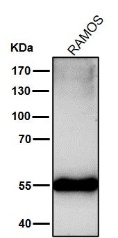 Anti-Mutant p53 Rabbit Monoclonal Antibody Boster Bio