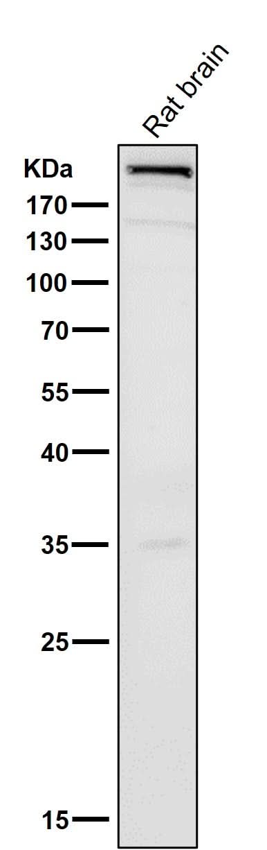 Anti-mTOR Rabbit Monoclonal Antibody Boster Bio