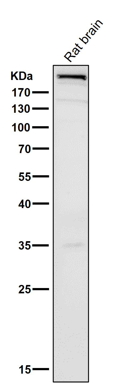 Anti-mTOR Rabbit Monoclonal Antibody Boster Bio
