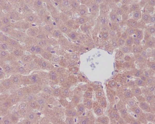 Anti-mTOR/Tor Rabbit Monoclonal Antibody Boster Bio