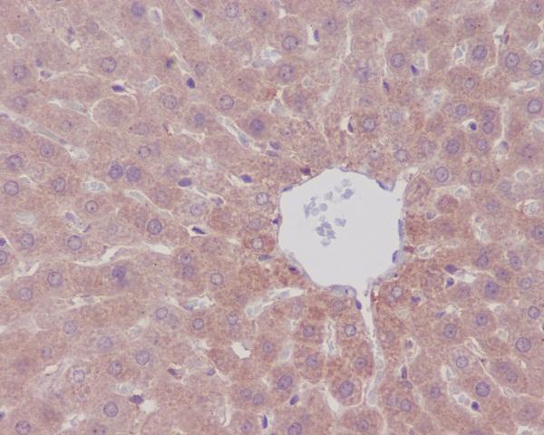 Anti-mTOR/Tor Rabbit Monoclonal Antibody Boster Bio
