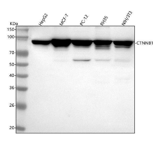 Anti-beta Catenin CTNNB1 Rabbit Monoclonal Antibody Boster Bio