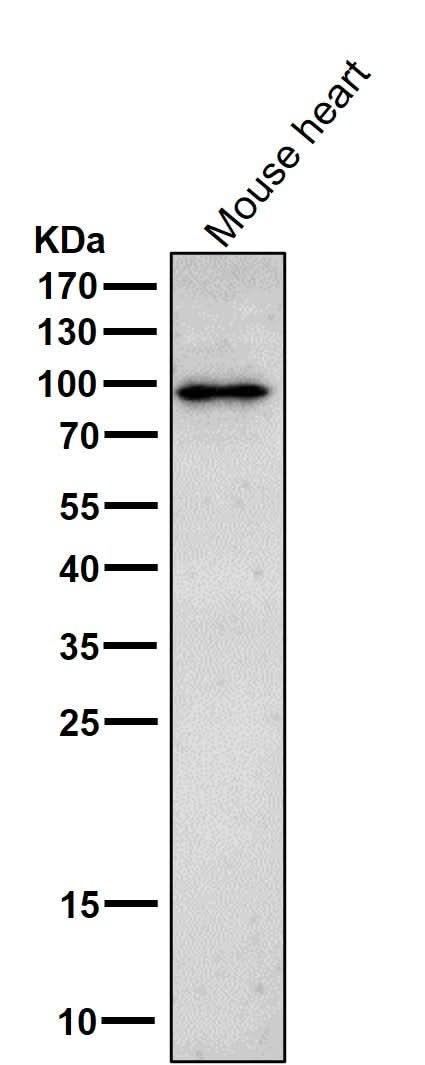 Anti-Phospho-beta Catenin (T41 + S45) Rabbit Monoclonal Antibody Boster Bio
