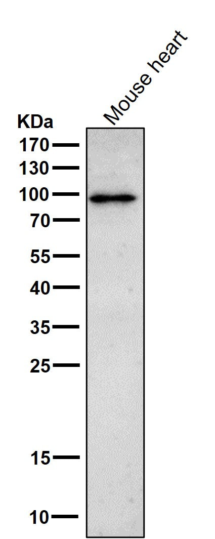 Anti-Phospho-beta Catenin (T41 + S45) Rabbit Monoclonal Antibody Boster Bio