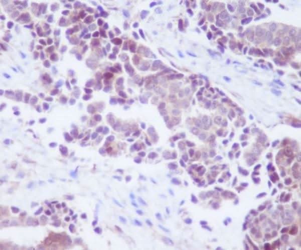 Anti-PTEN Rabbit Monoclonal Antibody Boster Bio
