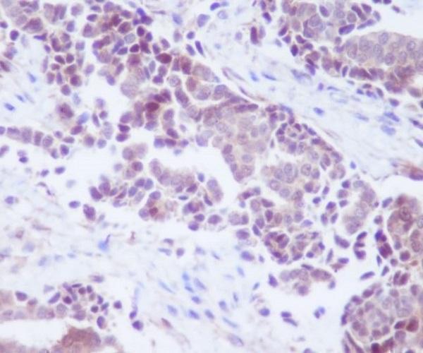 Anti-PTEN Rabbit Monoclonal Antibody Boster Bio