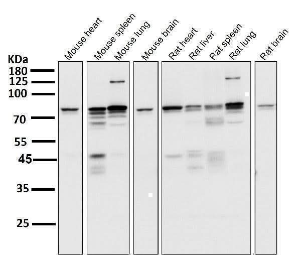 Anti-STAT3 Rabbit Monoclonal Antibody Boster Bio