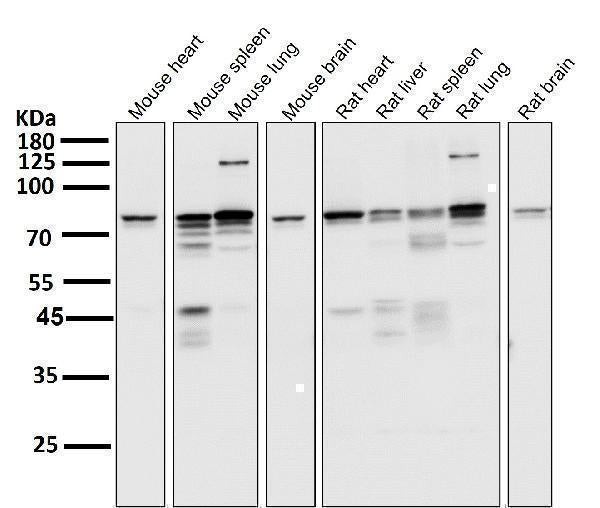 Anti-STAT3 Rabbit Monoclonal Antibody Boster Bio