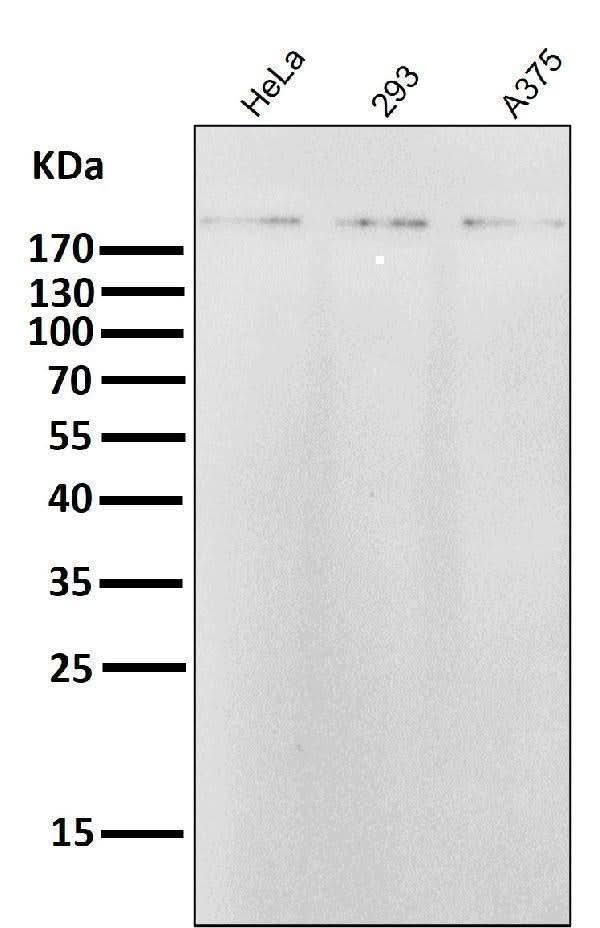 Anti-ErbB2 (HER2) Monoclonal Antibody Boster Bio