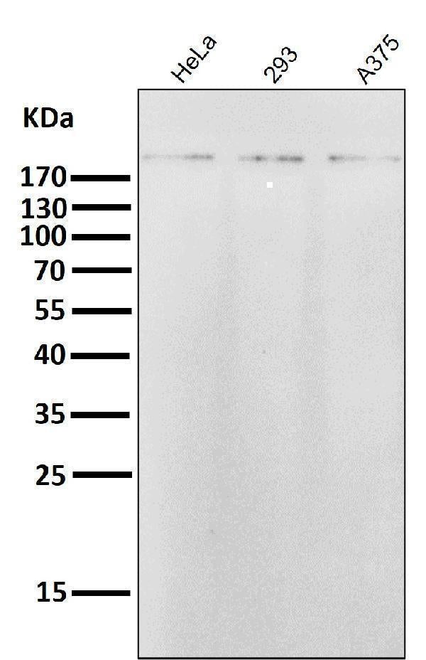 Anti-ErbB2 (HER2) Monoclonal Antibody Boster Bio