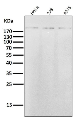 Anti-ErbB2 (HER2) Monoclonal Antibody Boster Bio