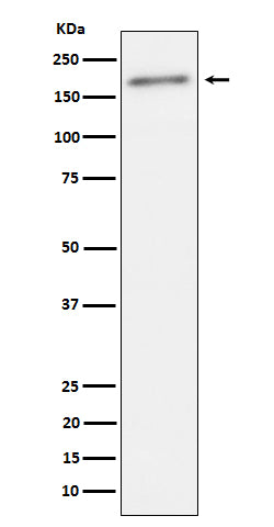 Anti-Phospho-ErbB2(Y1221 + Y1222) Rabbit Monoclonal Antibody Boster Bio