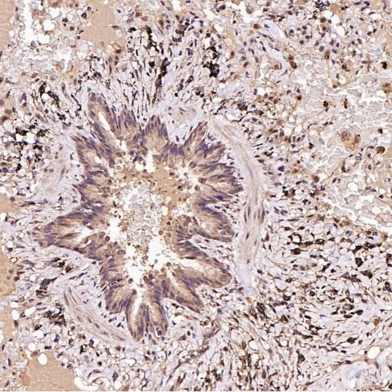 Anti-FOXP3 Rabbit Monoclonal Antibody Boster Bio