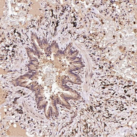 Anti-FOXP3 Rabbit Monoclonal Antibody Boster Bio