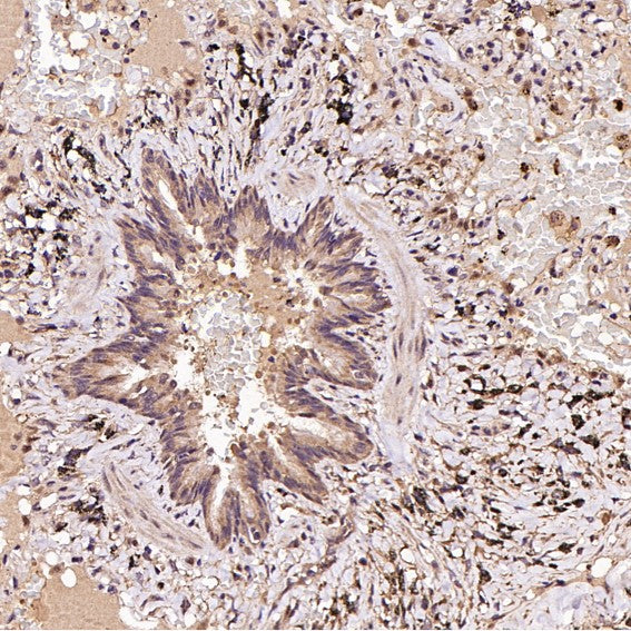Anti-FOXP3 Rabbit Monoclonal Antibody Boster Bio