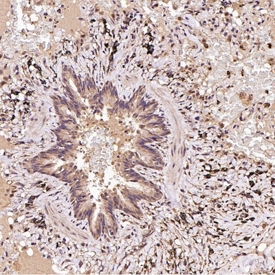 Anti-FOXP3 Rabbit Monoclonal Antibody Boster Bio