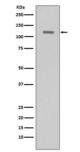 Anti-TERT Rabbit Monoclonal Antibody Boster Bio