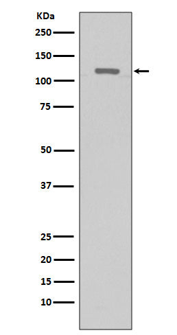 Anti-TERT Rabbit Monoclonal Antibody Boster Bio