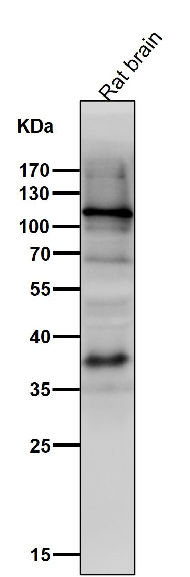 Anti-HIF-1 alpha Rabbit Monoclonal Antibody Boster Bio