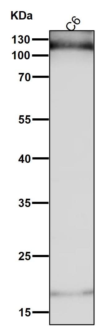 Anti-HIF-1-alpha Rabbit Monoclonal Antibody Boster Bio
