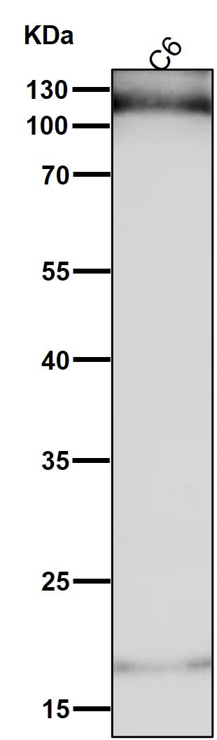 Anti-HIF-1-alpha Rabbit Monoclonal Antibody Boster Bio