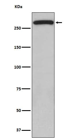 Anti-ATM Monoclonal Antibody Boster Bio