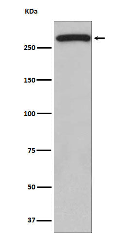 Anti-ATM Monoclonal Antibody Boster Bio