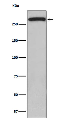 Anti-ATM Monoclonal Antibody Boster Bio