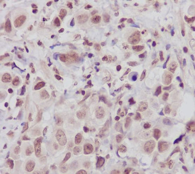Anti-ATM Monoclonal Antibody Boster Bio