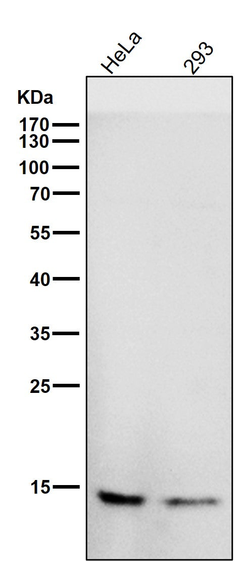 Anti-CDKN2A/p14ARF Rabbit Monoclonal Antibody Boster Bio